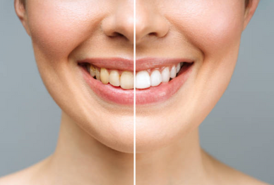 Unleash Your Confidence with a Dazzling Smile